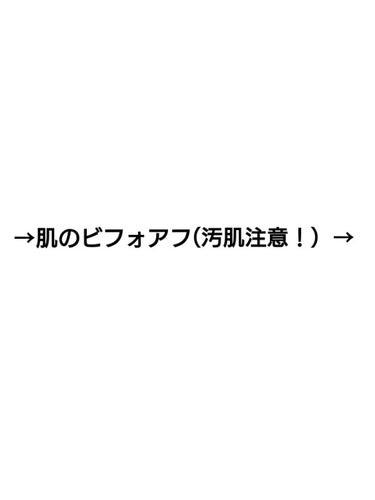 キル カバー ザ ニュー ファンウェア クッション/CLIO/クッションファンデーションを使ったクチコミ（5枚目）