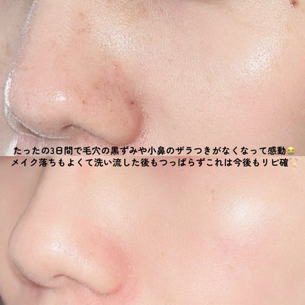 スムースクレンジングバーム/PERFECT ONE FOCUS/クレンジングバームを使ったクチコミ(5枚目)