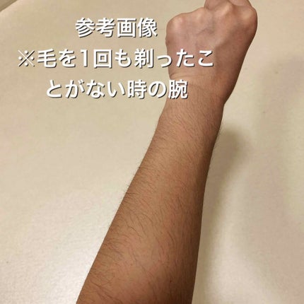 光美容器KE-NON(ケノン)/エムテック/家庭用脱毛器を使ったクチコミ(2枚目)
