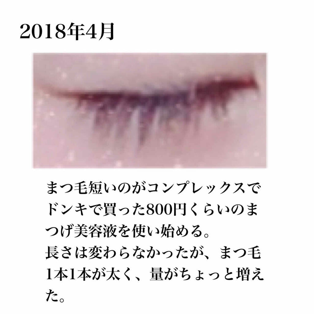 オリジナル ピュアスキンジェリー/ヴァセリン/ボディクリームを使ったクチコミ（2枚目）