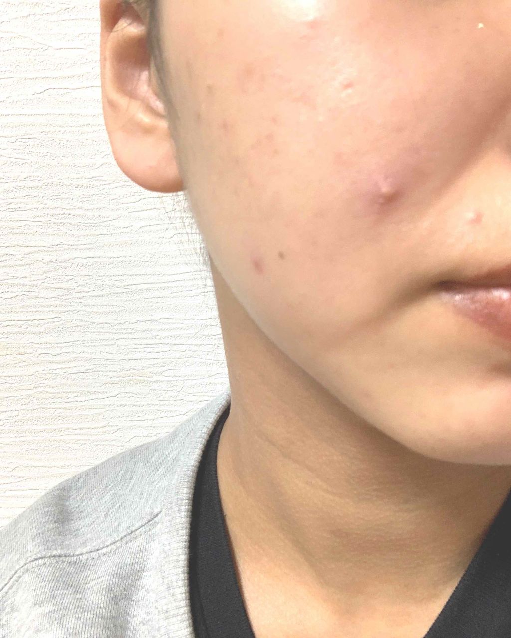 ノブ A アクネソープ/NOV/洗顔石鹸を使ったクチコミ(3枚目)