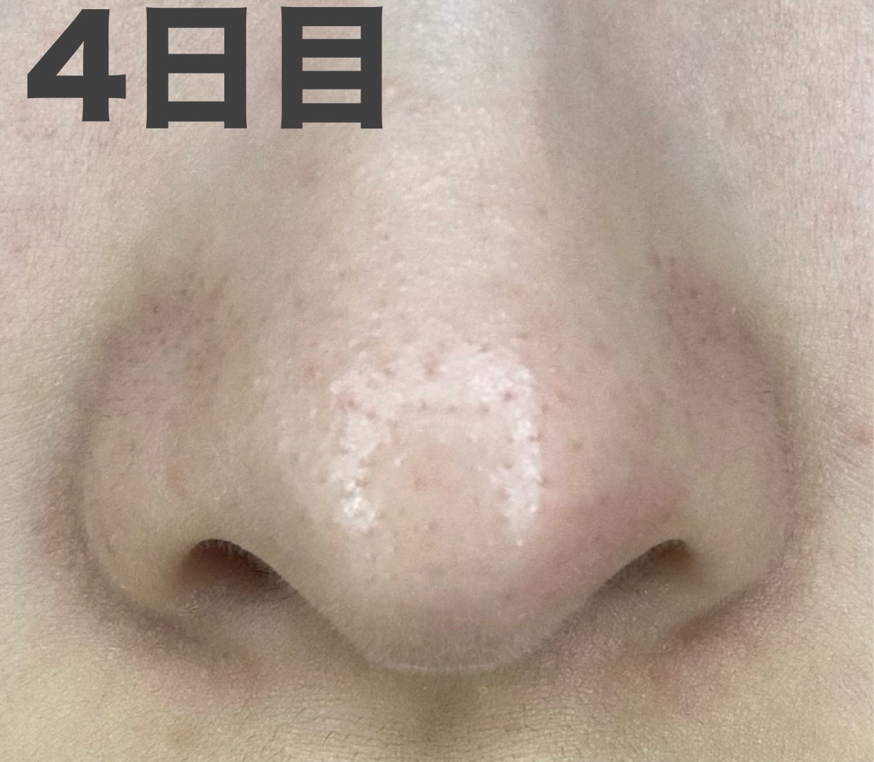 パーフェクトワンフォーカス スムースクレンジングバーム ディープブラック クロミ 限定デザイン（75g）/PERFECT ONE  FOCUS/クレンジングバームを使ったクチコミ（2枚目）