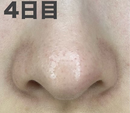 パーフェクトワンフォーカス スムースクレンジングバーム ディープブラック/PERFECT ONE FOCUS/クレンジングバームを使ったクチコミ(8枚目)