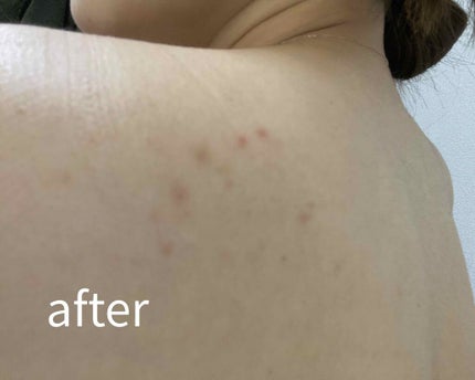 ロゼット洗顔パスタ アクネクリア/ロゼット/洗顔フォームを使ったクチコミ(3枚目)