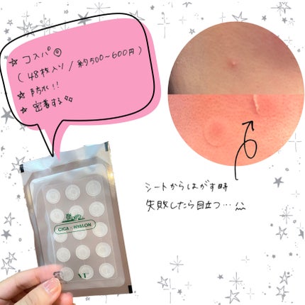 プロCICA クリアスポットパッチ/VT/その他スキンケアを使ったクチコミ(2枚目)