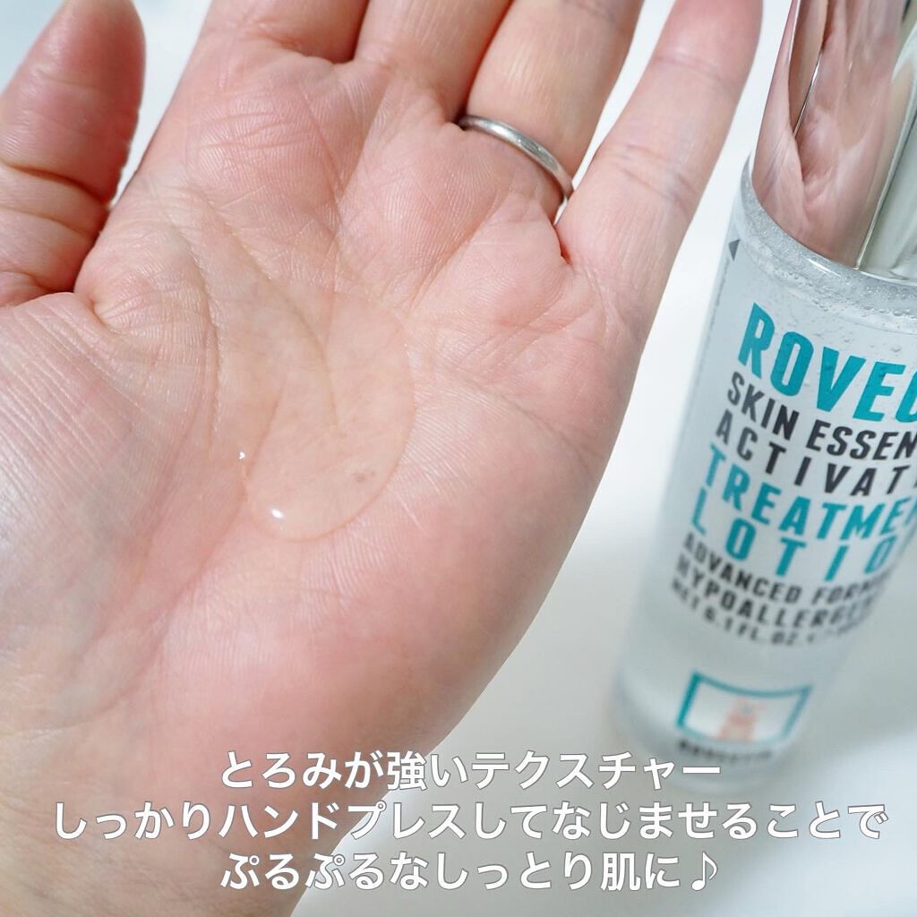 エッセンシャル トリートメントローション/ロベクチン/化粧水を使ったクチコミ(3枚目)