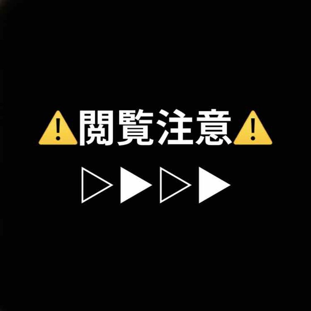 ミポキング on LIPS 「こんにちは!ポテトちゃんです!悩みです!!!!!!!この写真を..」(1枚目)