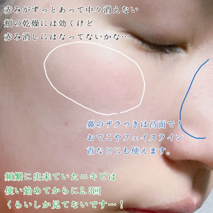 CICA クリーム/VT/フェイスクリームを使ったクチコミ(4枚目)