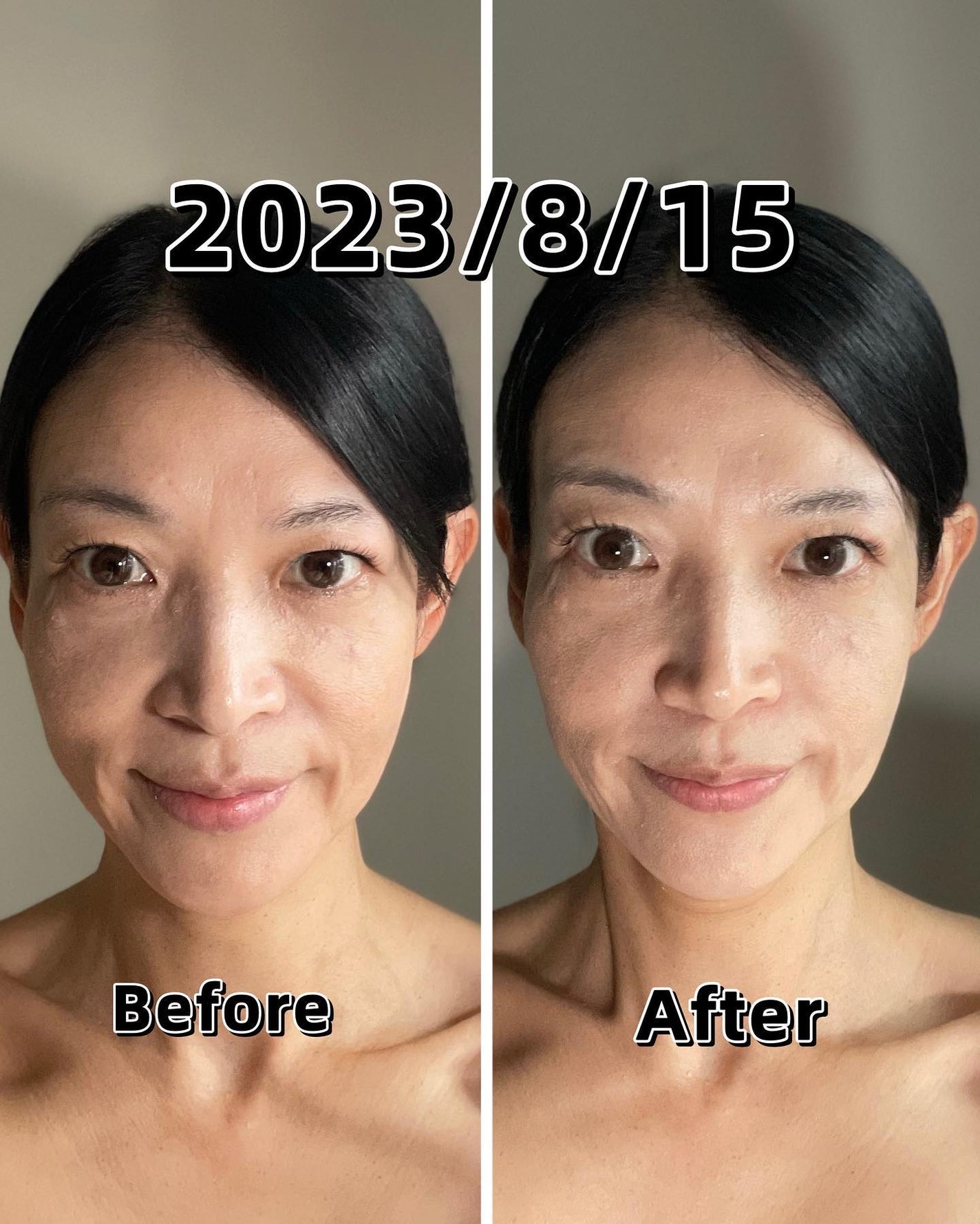 エクスイディアル オーヴォ/エクスイディアル/美顔器・マッサージを使ったクチコミ(3枚目)