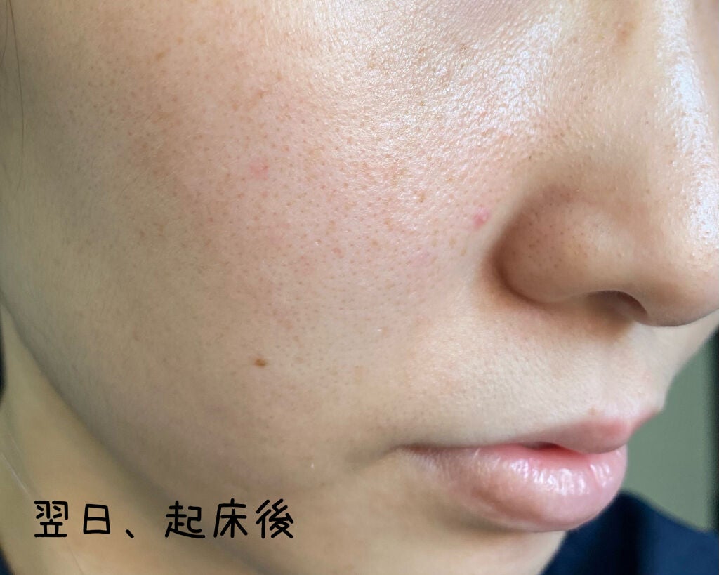 PHセンシティブマスクスージング&モイスト/SAM'U/シートマスク・パックを使ったクチコミ(4枚目)