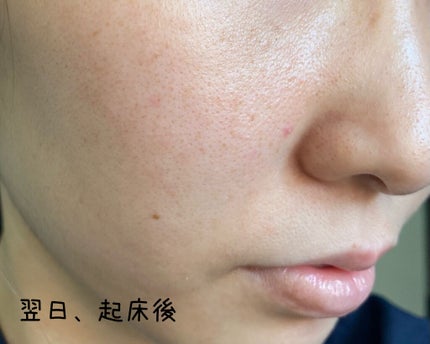 PHセンシティブマスクスージング&モイスト/SAM'U/シートマスク・パックを使ったクチコミ(4枚目)