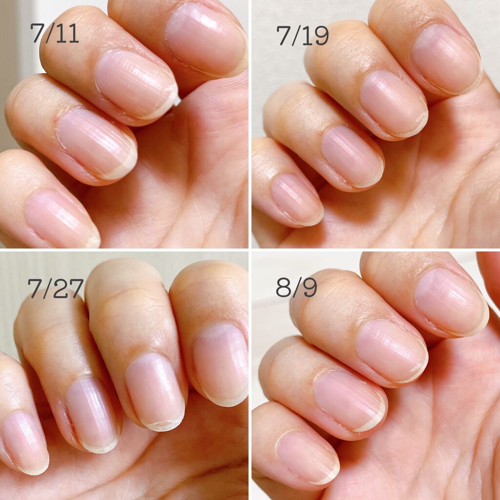 ネイリッチ/DHC/健康サプリメントを使ったクチコミ(6枚目)