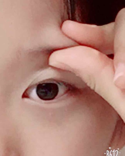 オロナインH軟膏 (医薬品)/オロナイン/その他を使ったクチコミ(2枚目)