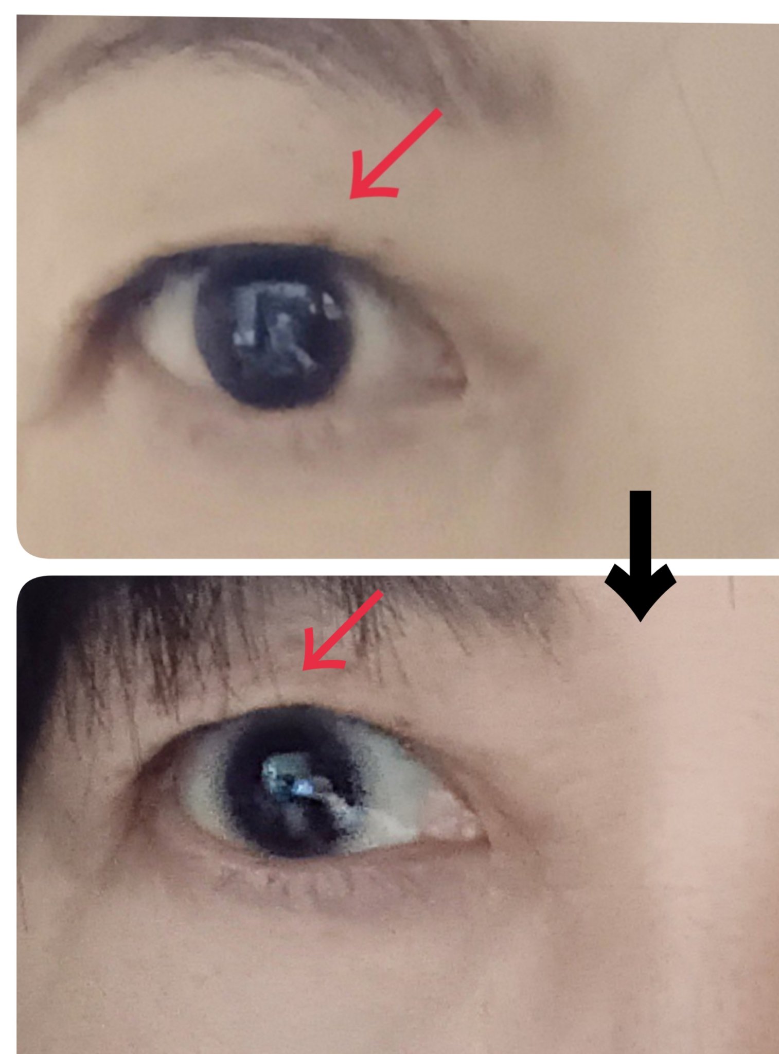 リッドキララ/北の快適工房/アイケア・アイクリームを使ったクチコミ（2枚目）