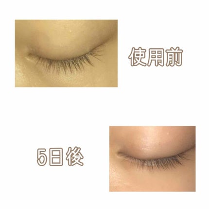 ローヤルゼリー配合 栄養ローション/DAISO/美容液を使ったクチコミ(2枚目)