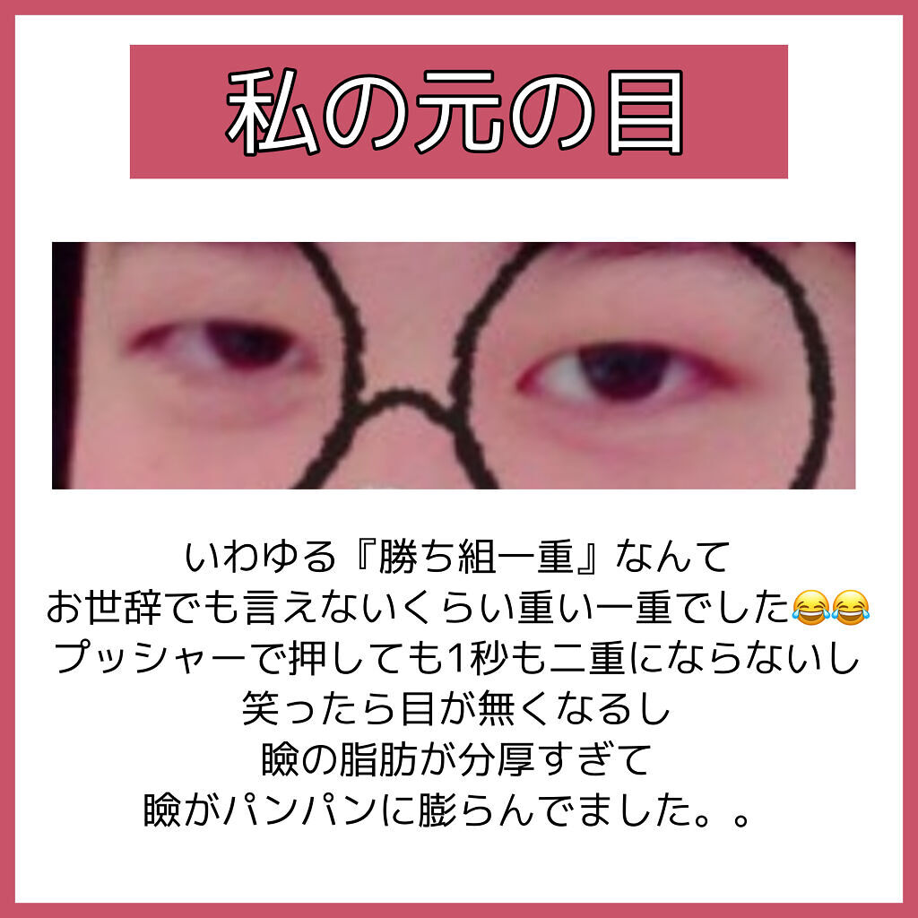 ワンダーアイリッドテープ Extra/D-UP/二重まぶた用アイテムを使ったクチコミ（2枚目）