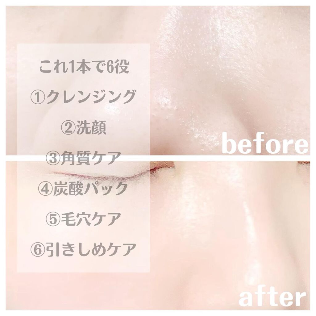 イセラ炭酸濃密泡クレンジング/フロムココロ/泡洗顔を使ったクチコミ(2枚目)