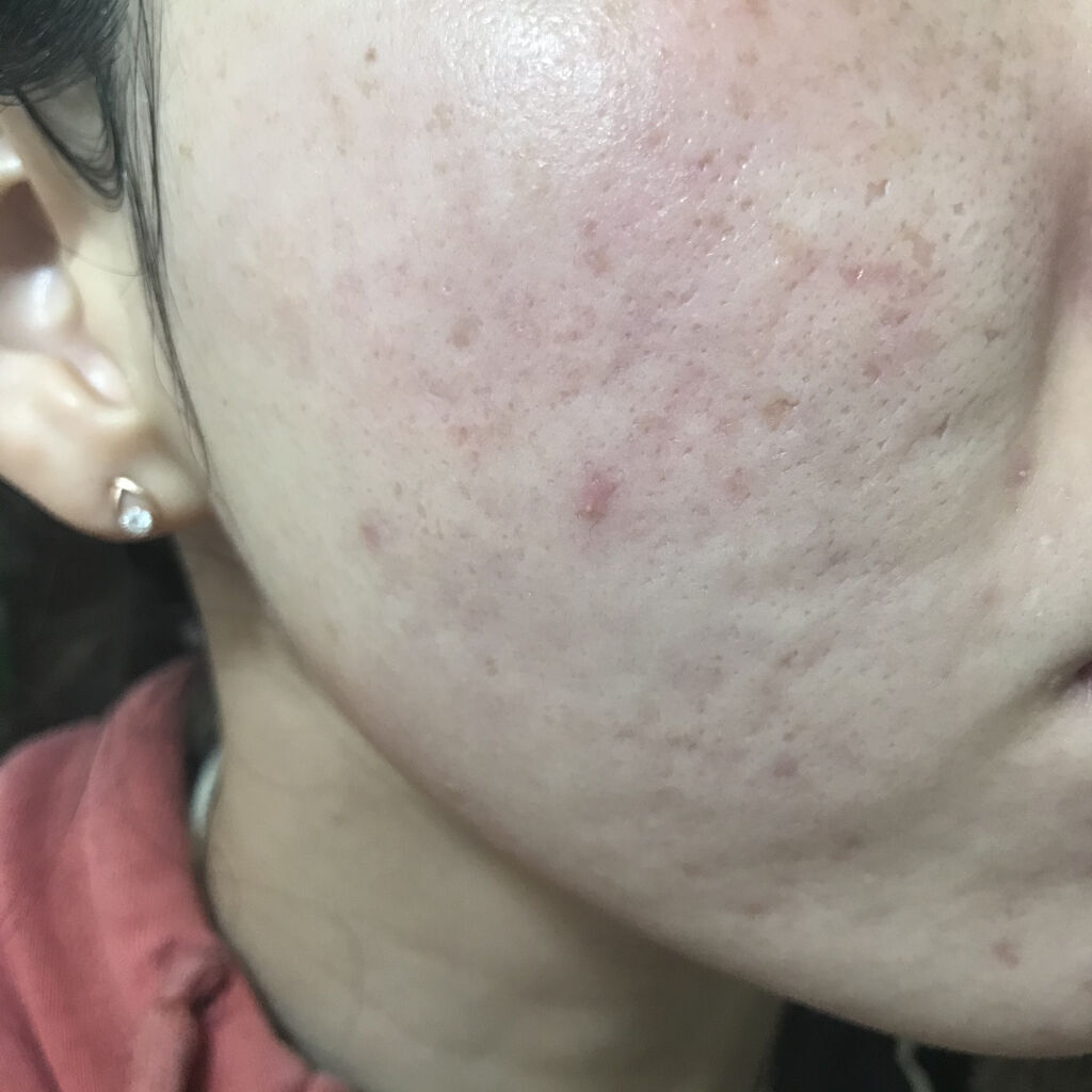 ゼン ウェア フルイド N22/DECORTÉ/リキッドファンデーションを使ったクチコミ（3枚目）