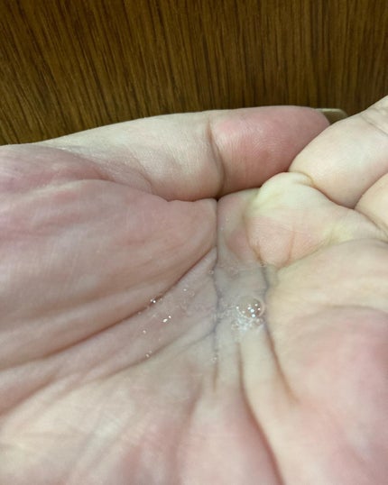 manage 01+ リッチローション/manage/化粧水を使ったクチコミ(4枚目)