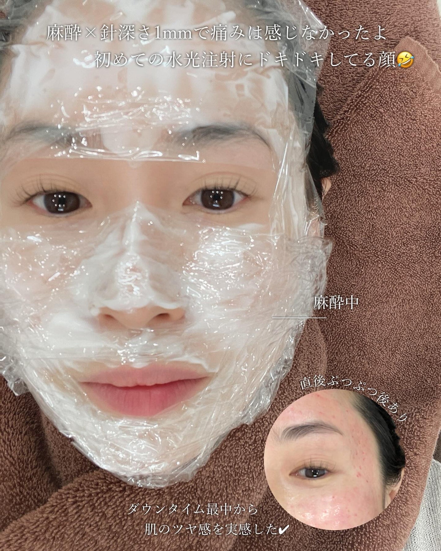 mayuðª·ãã©ããâ© on LIPS ãæ¥ã
ã®ã±ã¢ãšç¿æ
£ã§-9æ³èãå¶ããå
ïŸïŸïŸã®ææ°çŸå®¹æ
å ±ð@..ãïŒ5æç®ïŒ