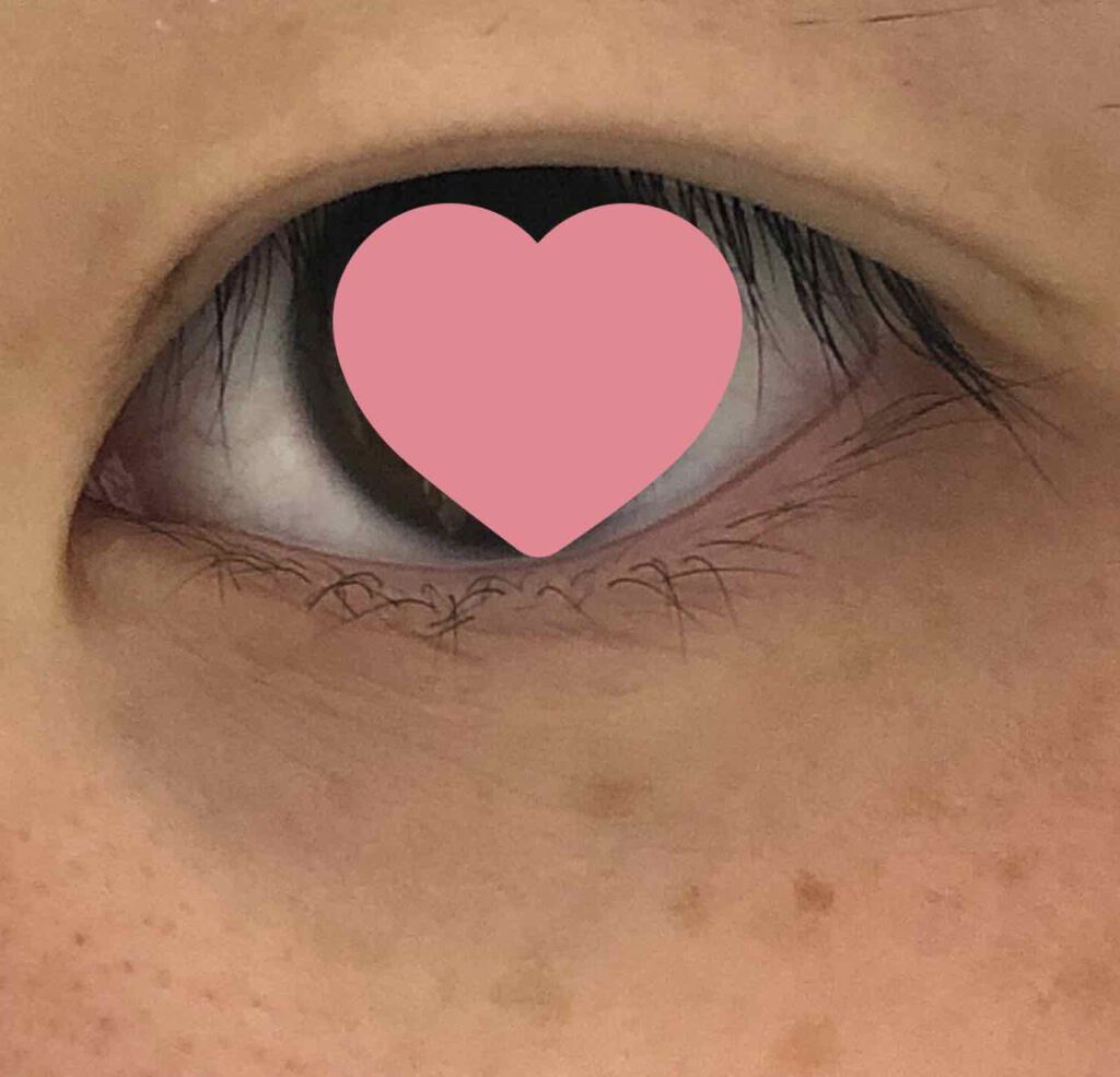 アイビューティー フィクサー WP/アストレア ヴィルゴ/二重まぶた用アイテムを使ったクチコミ（2枚目）