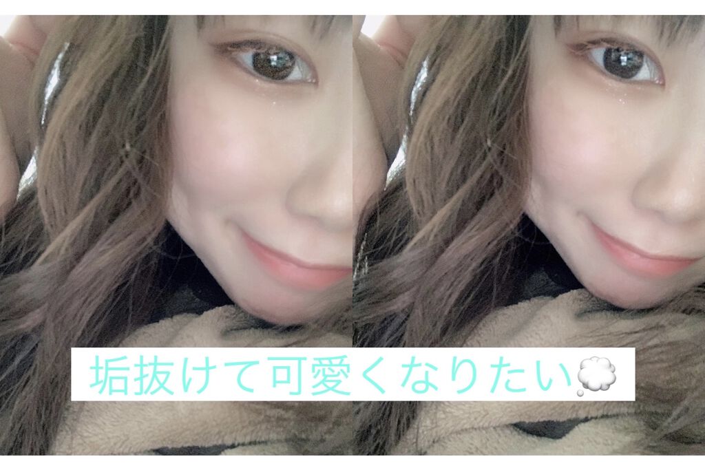 脱色クリーム 敏感肌用/エピラット/ムダ毛ケアを使ったクチコミ（1枚目）