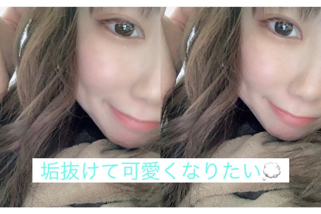 脱色クリーム 敏感肌用/エピラット/ムダ毛ケアを使ったクチコミ(1枚目)