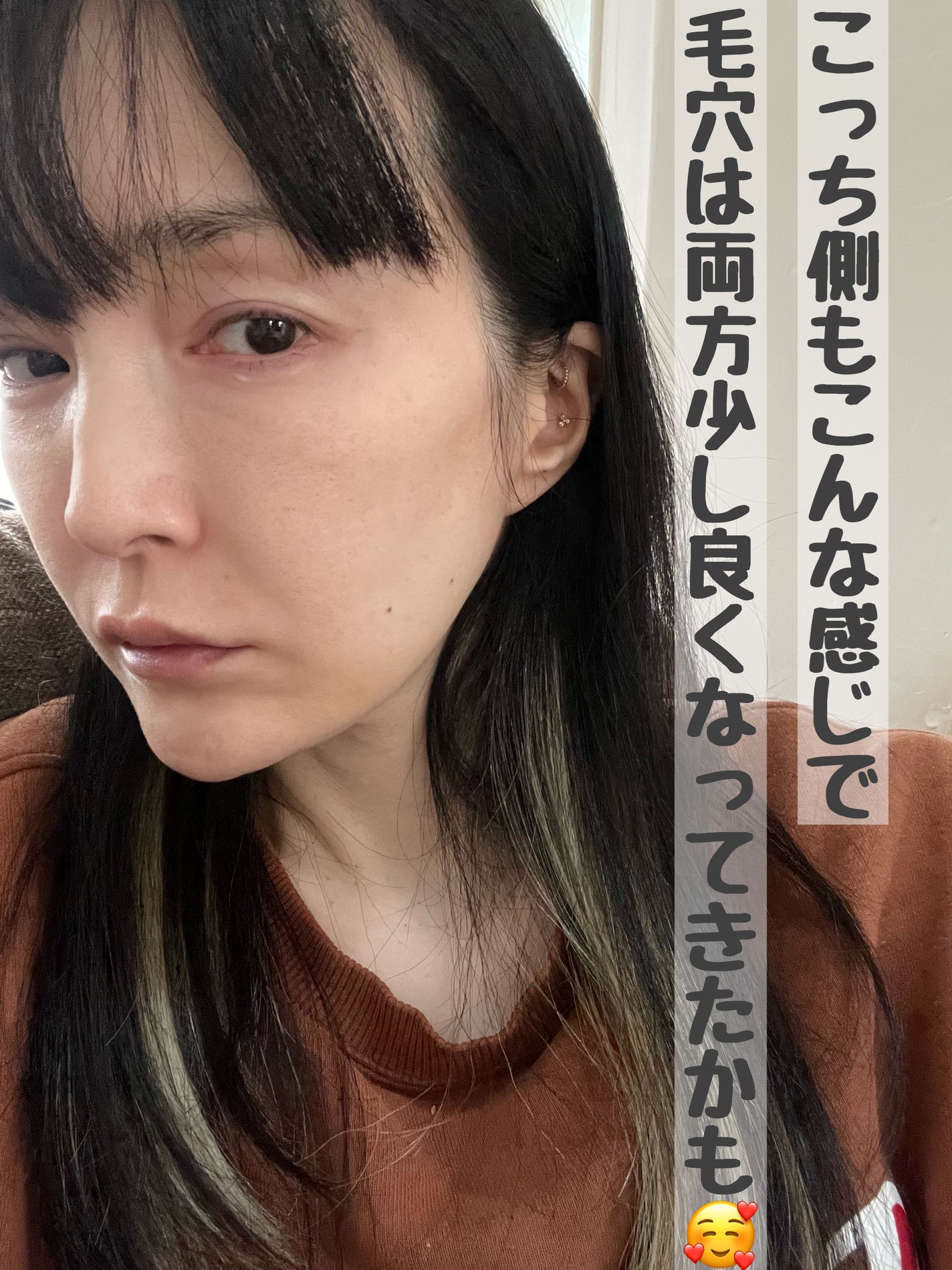 ハトムギ浸透乳液(ナチュリエ スキンコンディショニングミルク)/ナチュリエ/乳液を使ったクチコミ(2枚目)