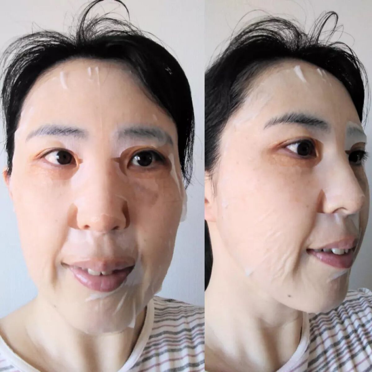 シカアルブチンマスク/NOWATER/シートマスク・パックを使ったクチコミ(3枚目)