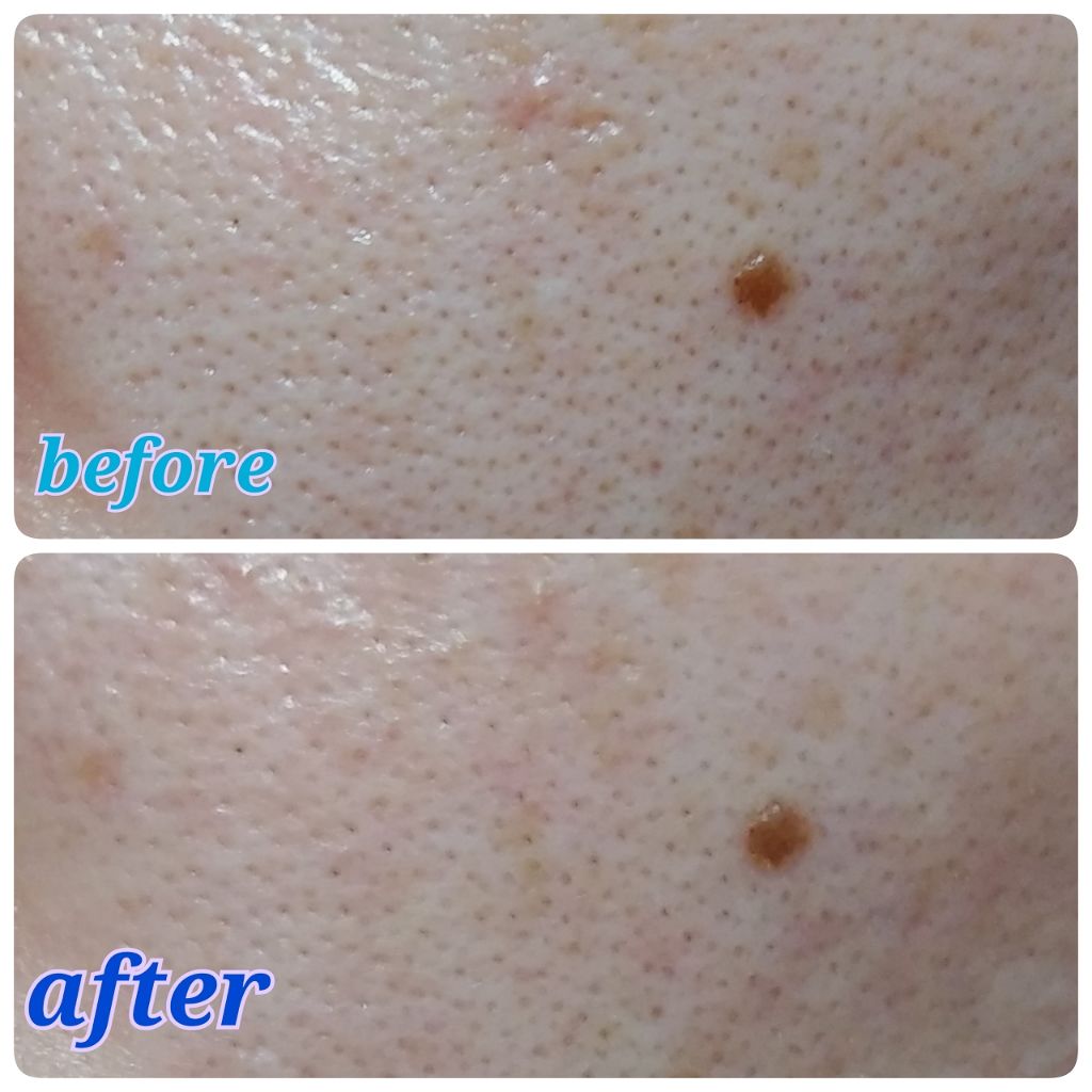 クレイウォッシュ/b.glen/洗顔フォームを使ったクチコミ(3枚目)