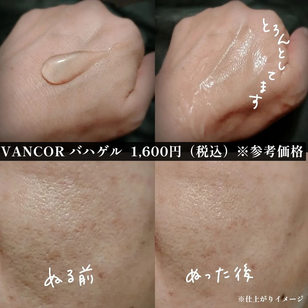 モイストバハゲル(BHA gel)/vancor(バンコル)/ピーリングを使ったクチコミ（2枚目）