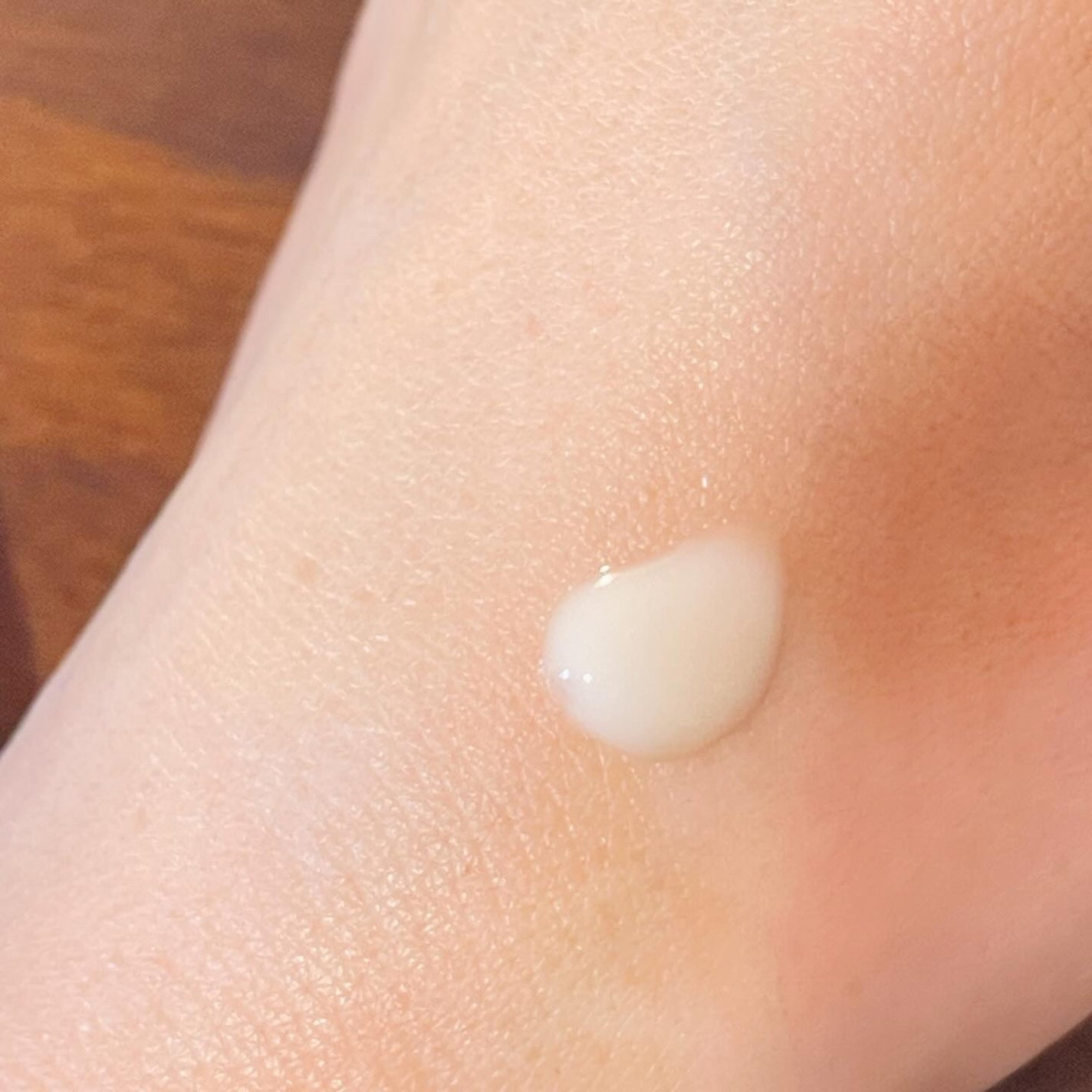 ブラックスネイル クリーム/Dr.G/フェイスクリームを使ったクチコミ(3枚目)