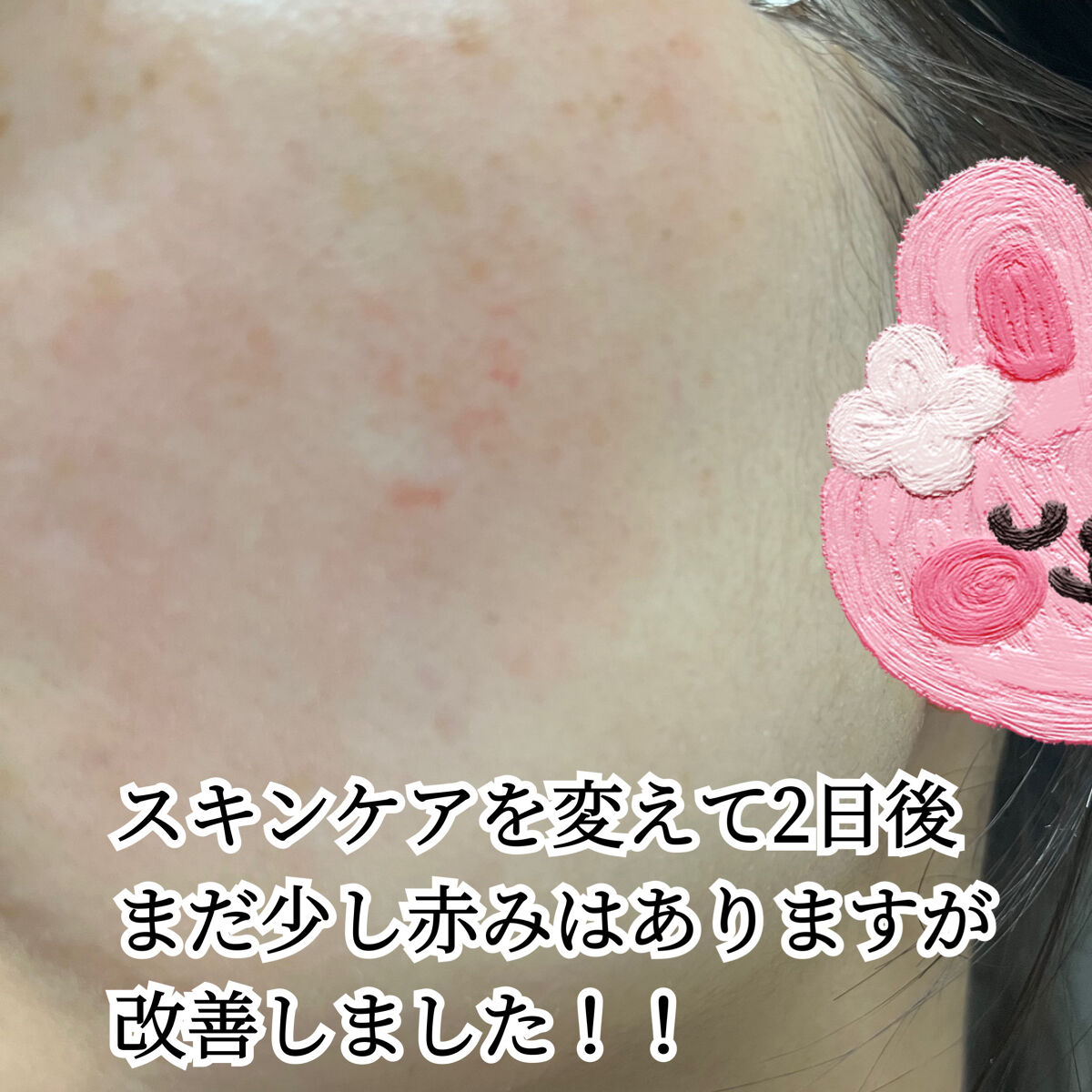 ル・マイルド乳液/ル・マイルド/乳液を使ったクチコミ（3枚目）