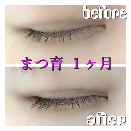 EMAKED(エマーキット)/水橋保寿堂製薬/まつげ美容液を使ったクチコミ(2枚目)