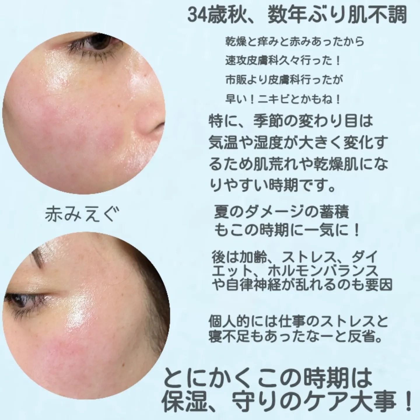 潤浸保湿 色づくベースミルク /キュレル/日焼け止めミルクを使ったクチコミ（2枚目）