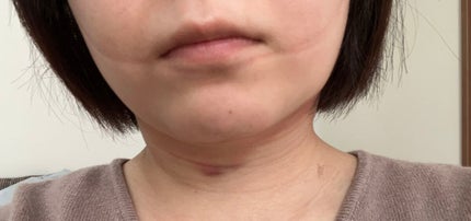 ãœãðãã©ãã100 on LIPS ãé¡äžã®èèªåžåŒãšç³žãªããããã£ãŠããŸãã^^åèã«ããŠããã ã..ãïŒ4æç®ïŒ