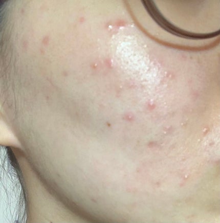 ドクタージャルト シカペア クリーム (第2世代)/Dr.Jart+/フェイスクリームを使ったクチコミ(2枚目)