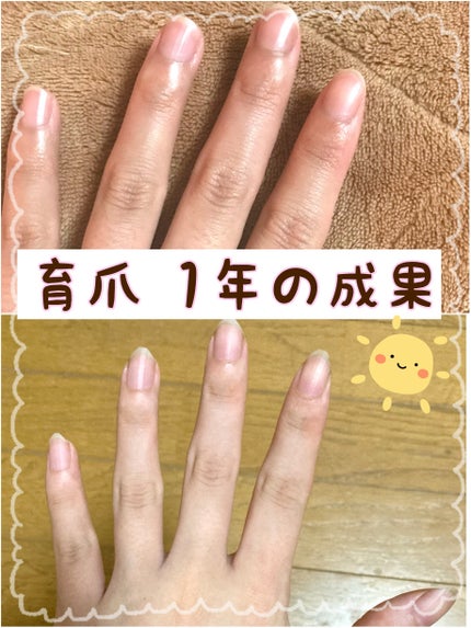 ポニキウムオイル/enieni /ネイルオイル・トリートメントを使ったクチコミ(1枚目)