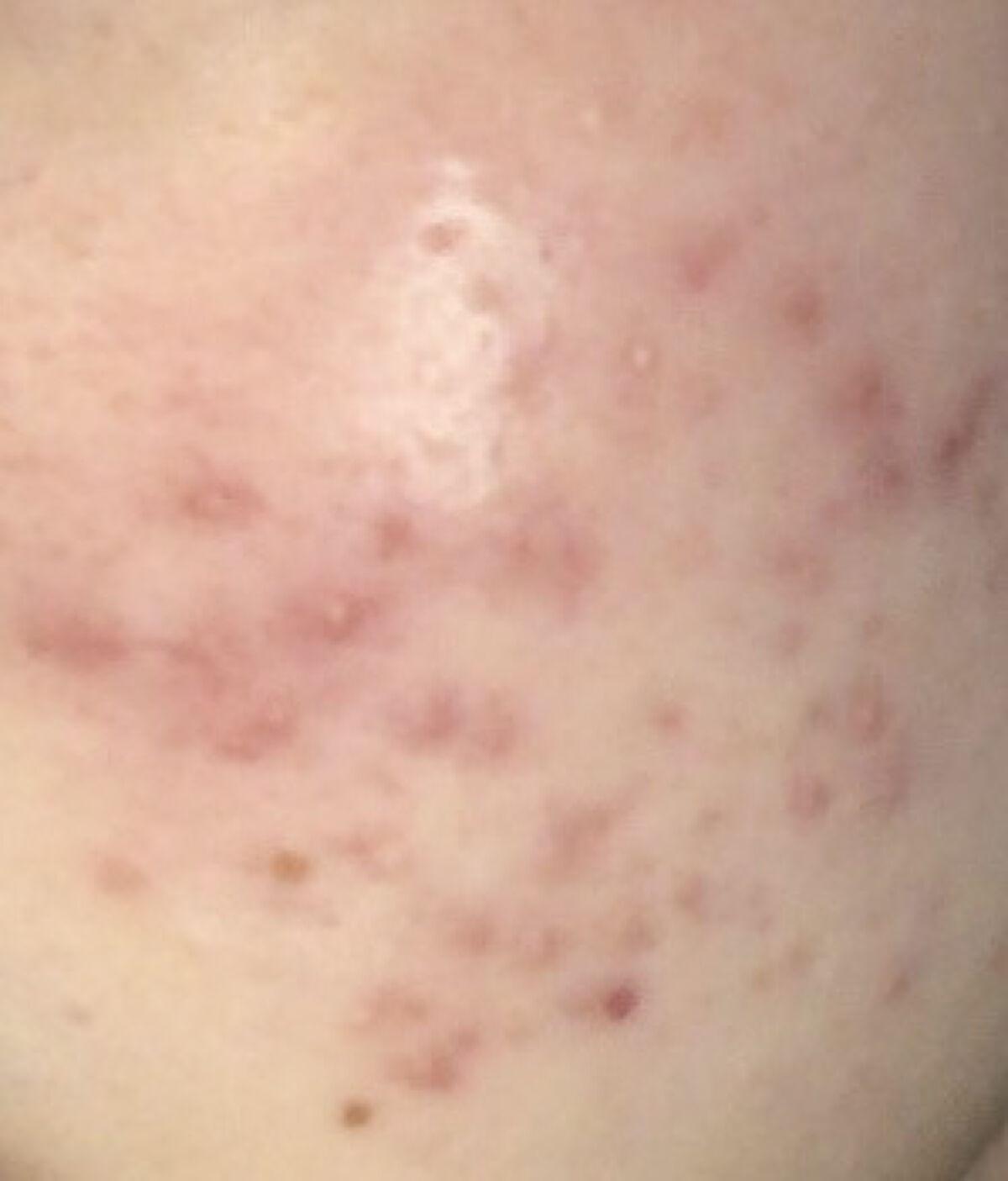 ハトムギ化粧水(ナチュリエ スキンコンディショナー R )/ナチュリエ/化粧水を使ったクチコミ（2枚目）