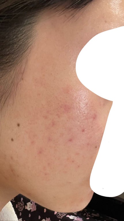 㪠㪠ð§žâ¡ on LIPS ããããæ¥èš6é±éç®2021/03/18ææŽé¡æããŒãããã¹ã¿é..ãïŒ4æç®ïŒ