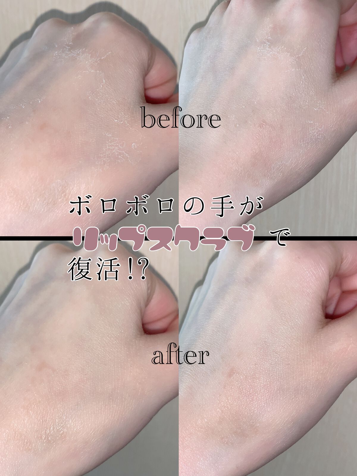 シュガーリップスクラブ/CHOOSY/リップスクラブを使ったクチコミ（1枚目）