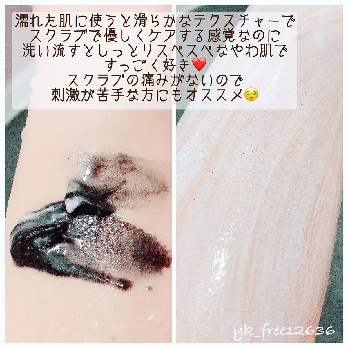 ソルシアボディスクラブ/fonskin/ボディスクラブを使ったクチコミ(4枚目)