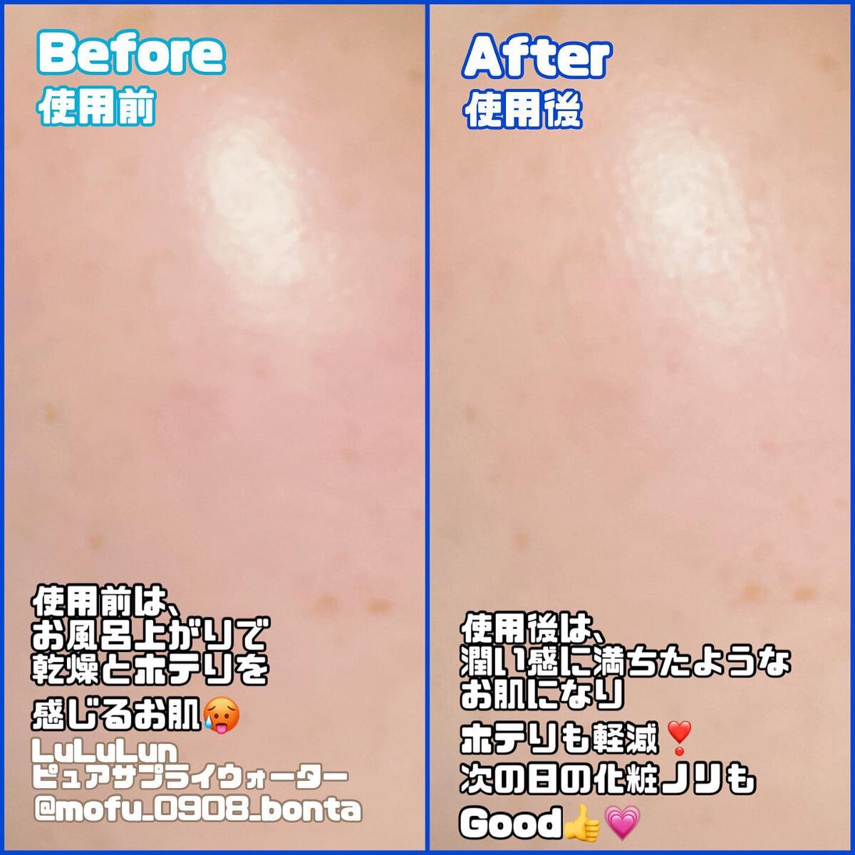 ルルルンピュア サプライウォーター/ルルルン/シートマスク・パックを使ったクチコミ（3枚目）