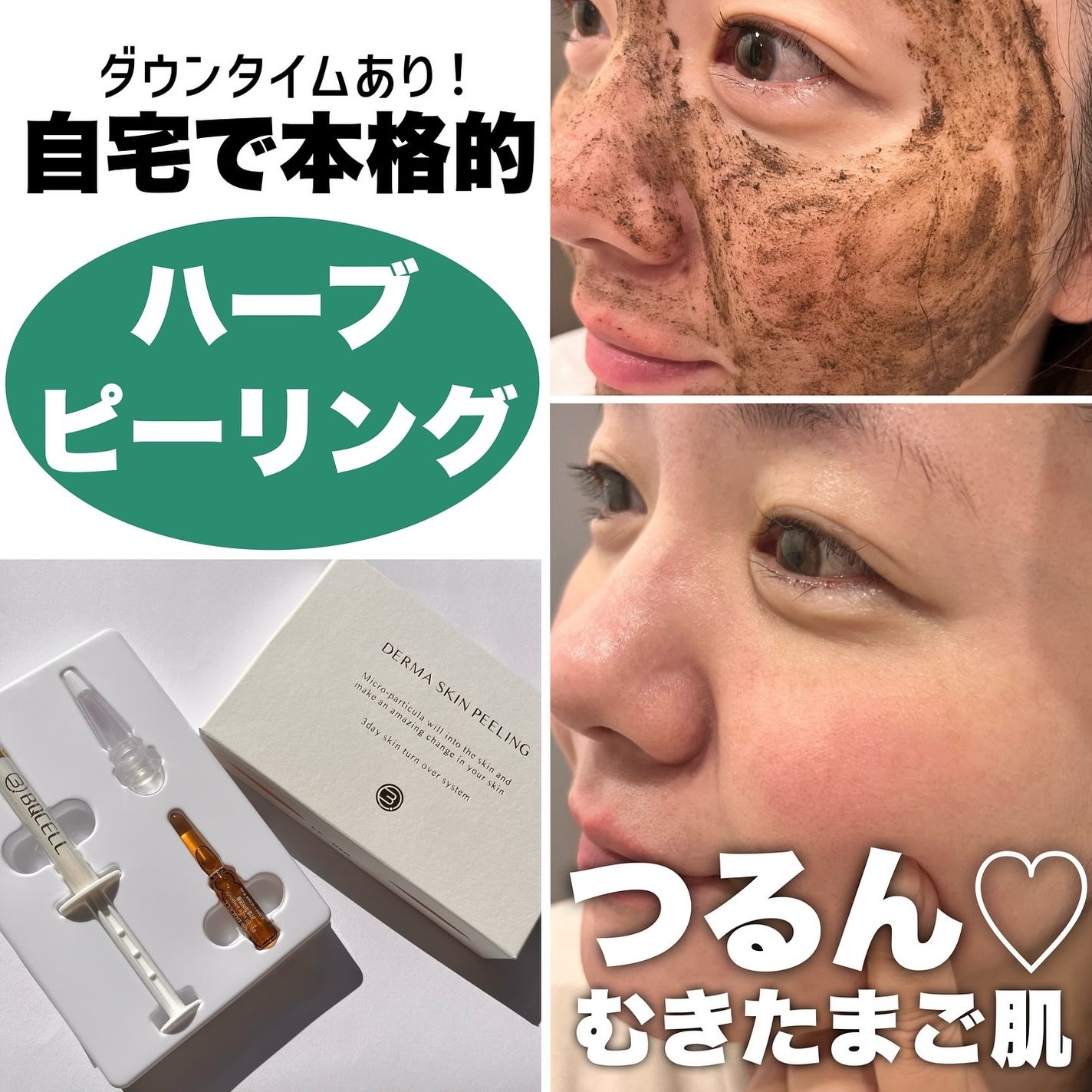 ダーマスキンピーリング/BQCELL/その他キットセットを使ったクチコミ(1枚目)