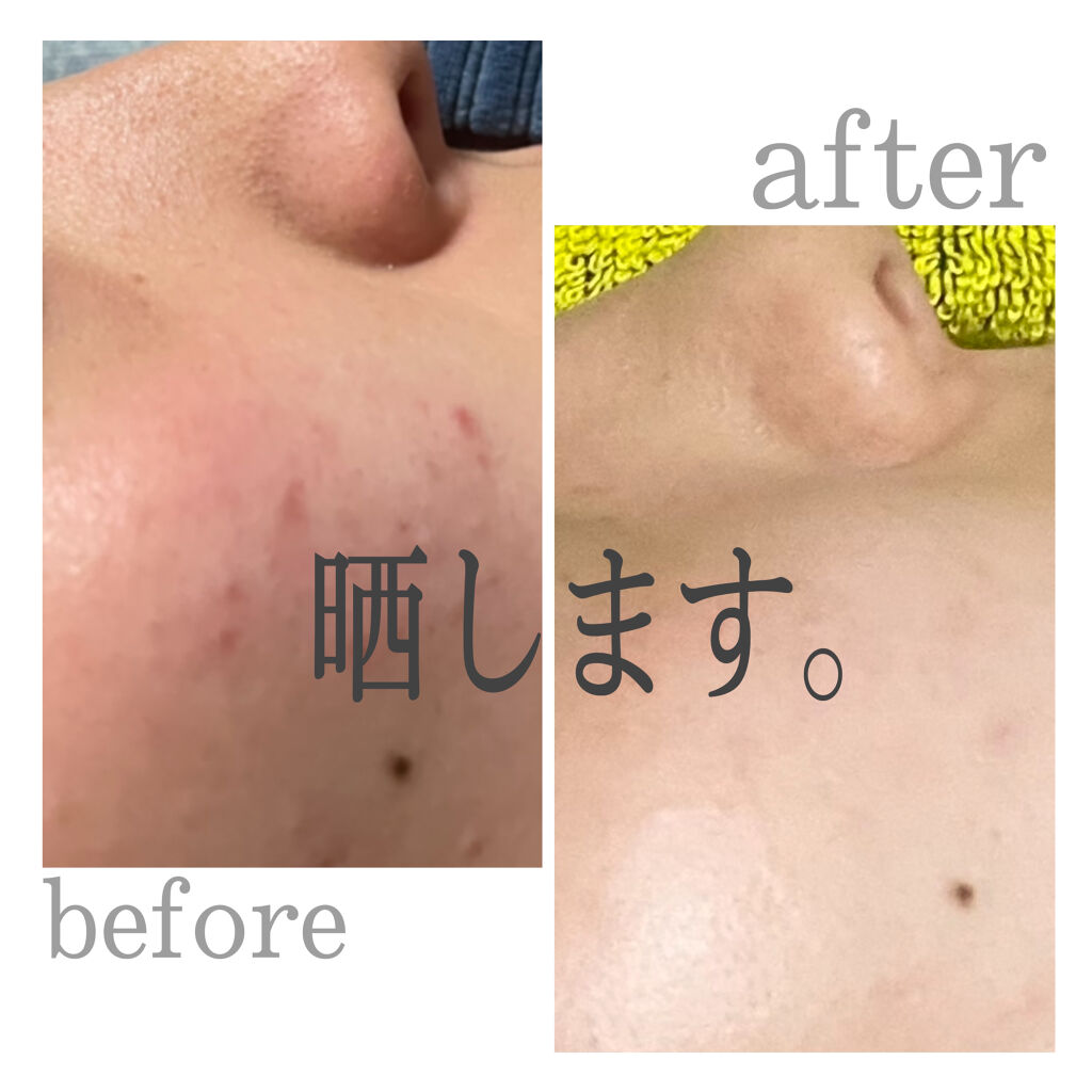 アクアコラーゲンゲルマチュアリフトEX /ドクターシーラボⓇ/オールインワン化粧品を使ったクチコミ（1枚目）