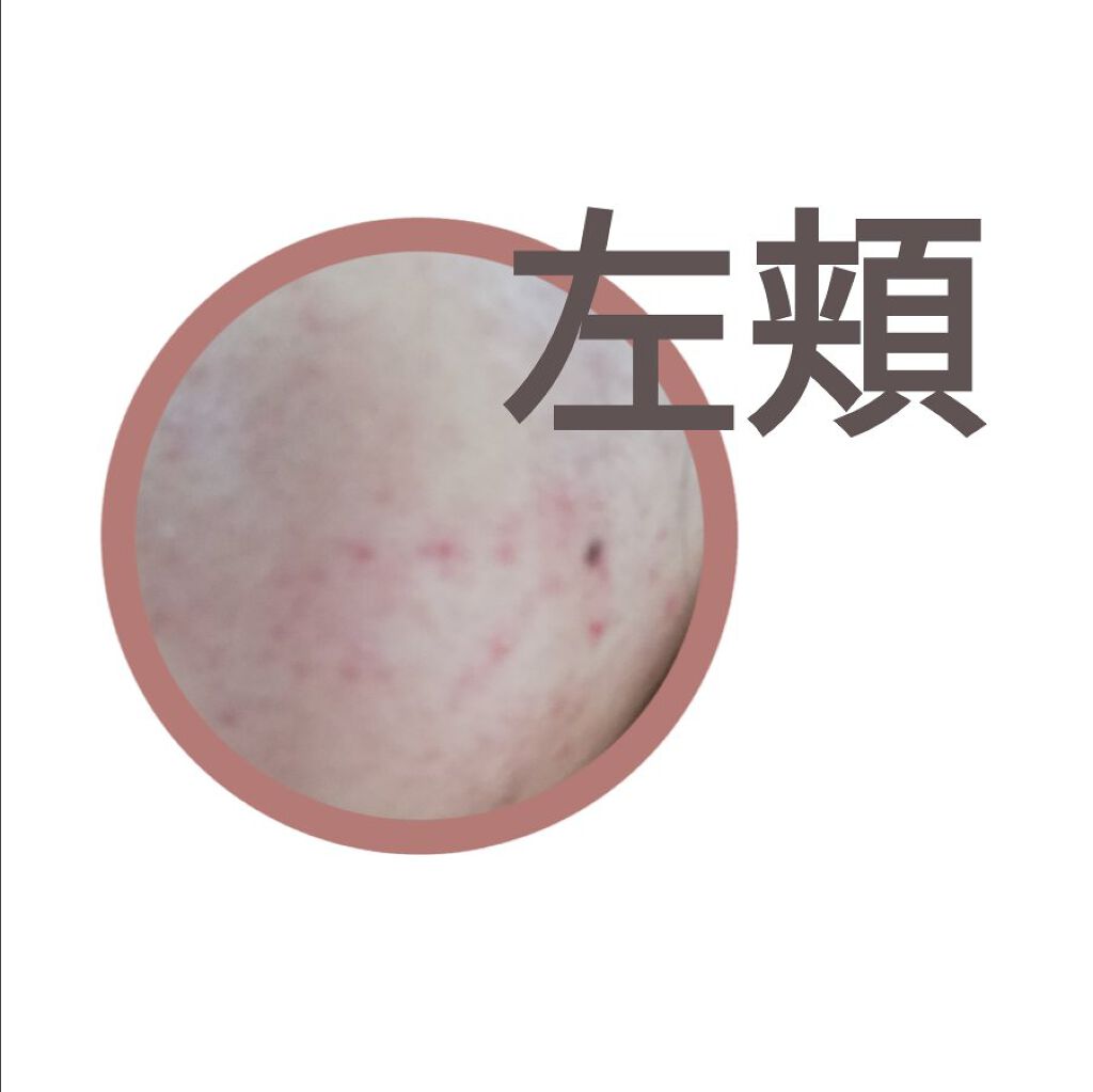 DHC マルチビタミン/DHC/美容サプリメントを使ったクチコミ(2枚目)