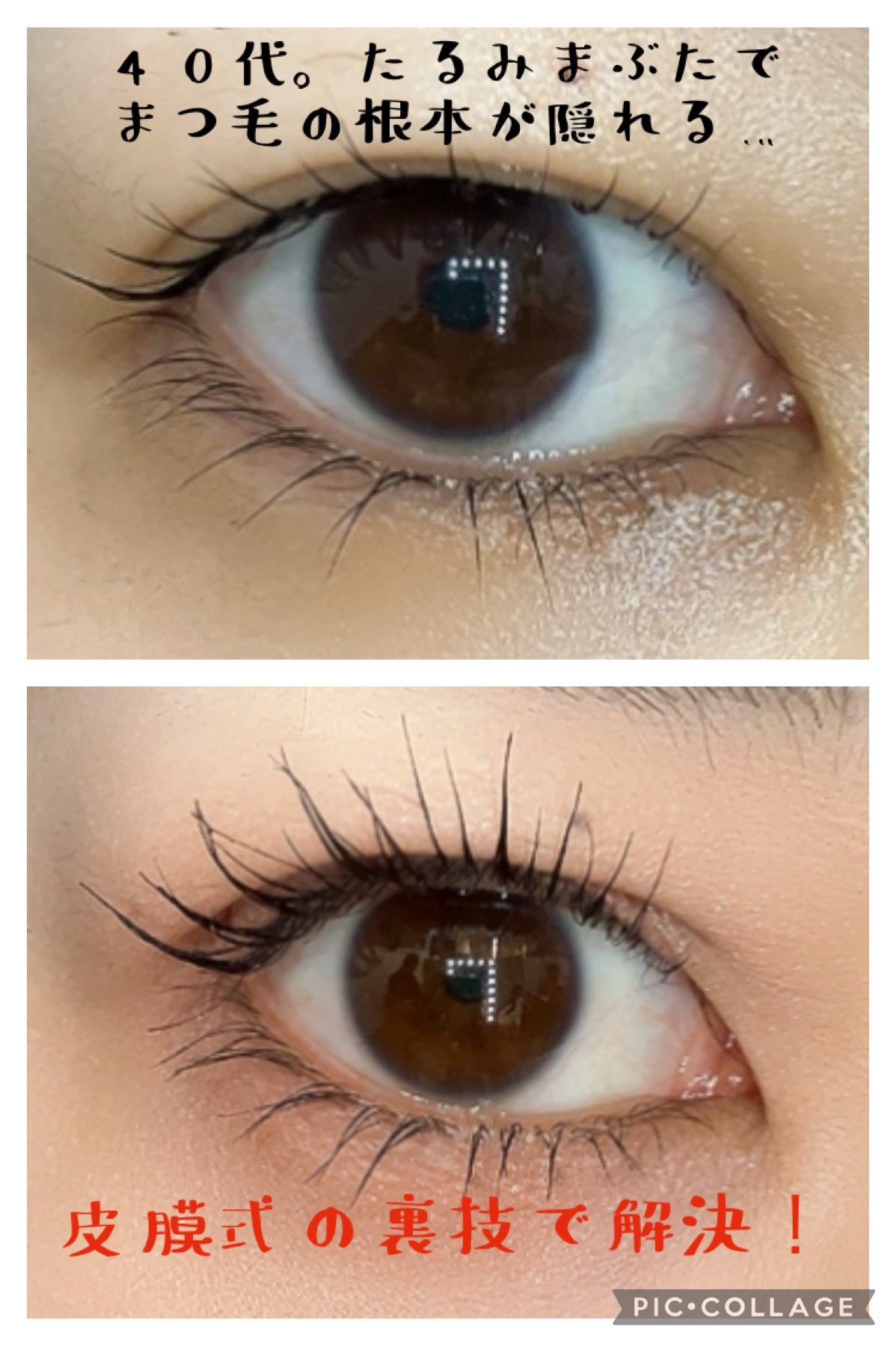 メザイク クリップ カッター ファイバー専用カッター/メザイク/二重まぶた用アイテムを使ったクチコミ(1枚目)