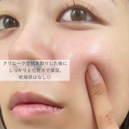 クラリファイング ローション 2/CLINIQUE/拭き取り化粧水を使ったクチコミ(5枚目)