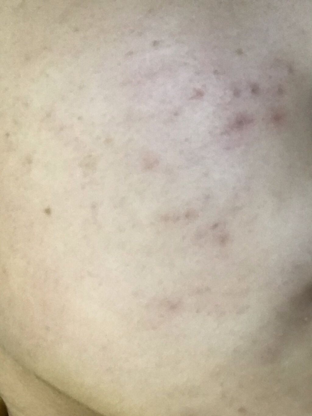 菊正宗 日本酒の化粧水 高保湿/菊正宗/化粧水を使ったクチコミ（2枚目）