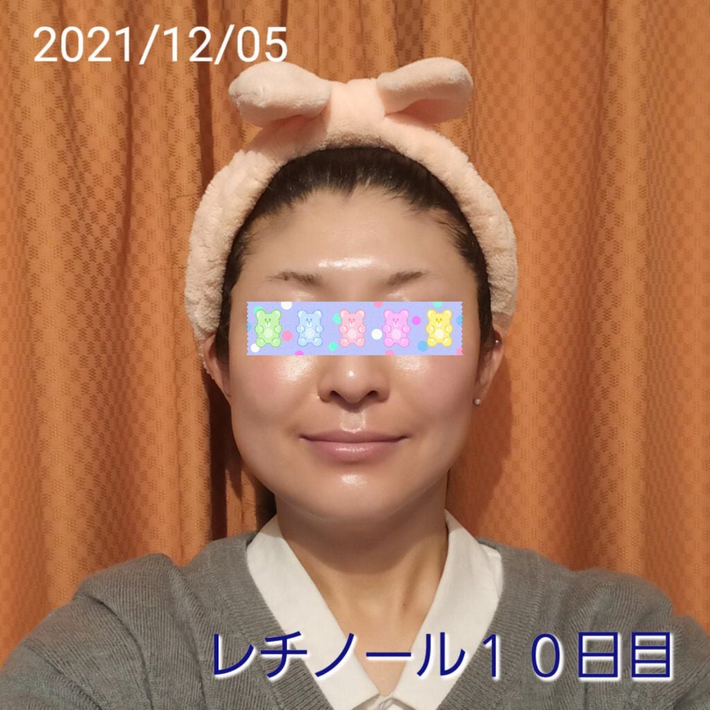 トレチノインジェル/A-Ret/美容液を使ったクチコミ(1枚目)